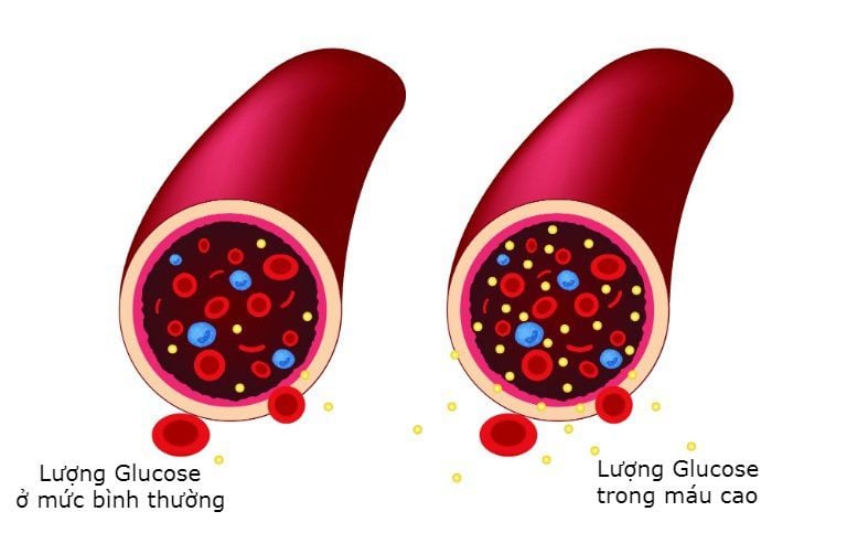 Ăn vặt ít calo giúp giảm lượng đường huyết trong máu